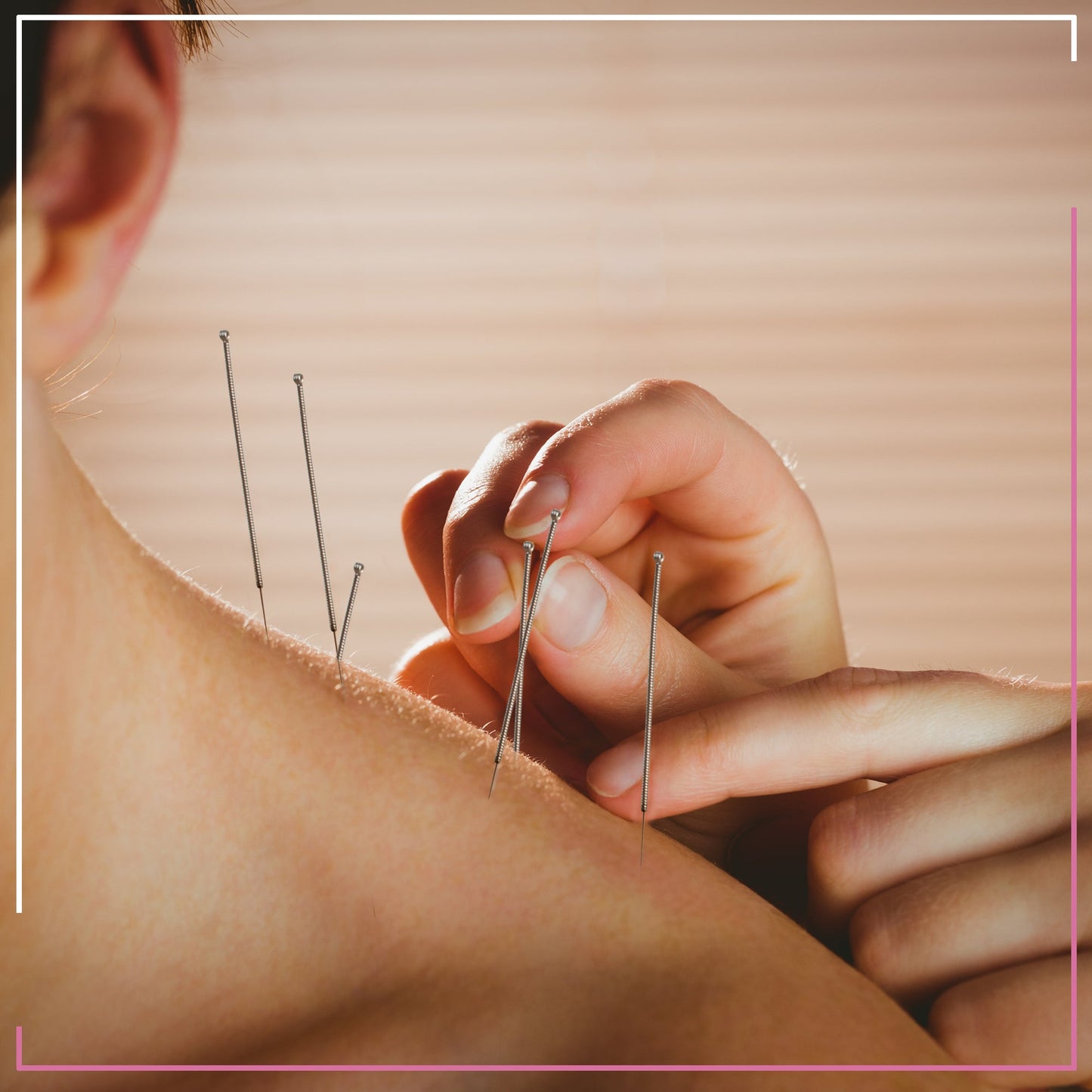 15mm - Ten-Chi Premium Acupuncture Needles